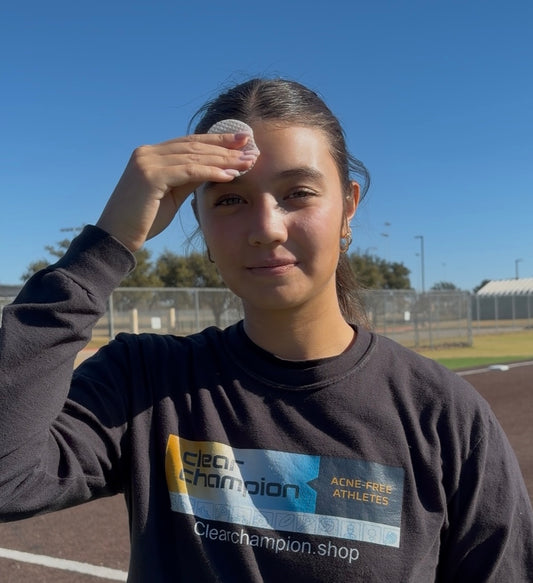 Breakout prevention wipes designed for teen athletes