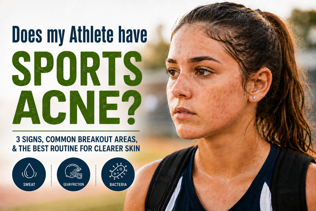 Does My Athlete Have Sports Acne?