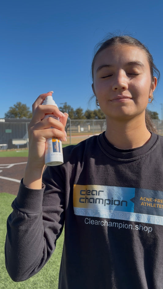Sports acne spray designed for teen athlete skin