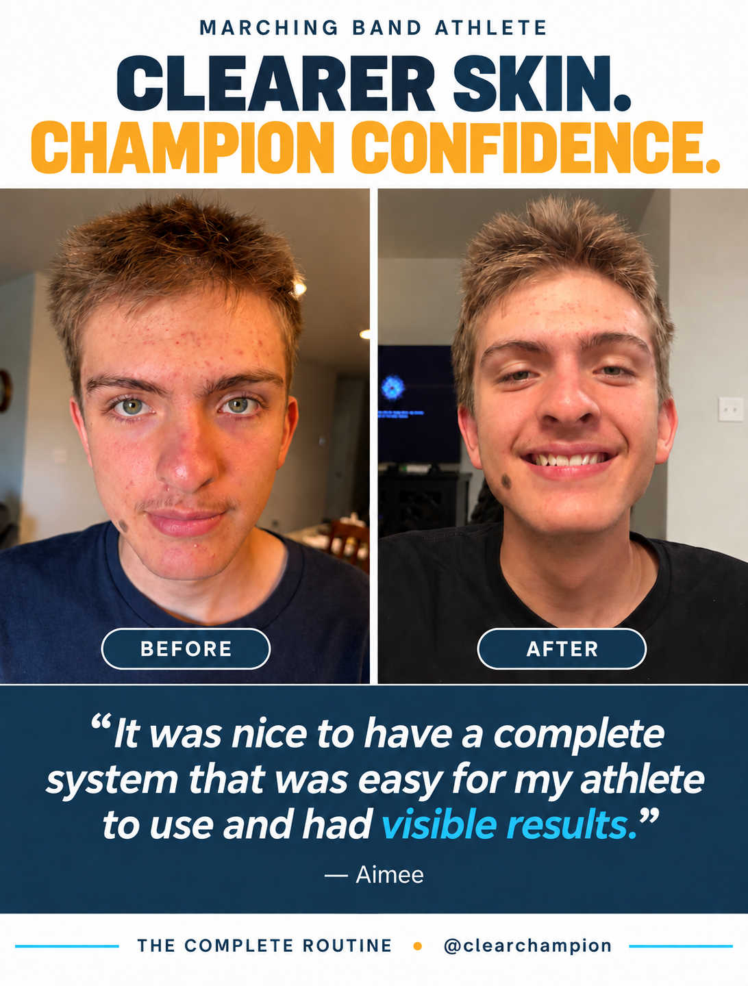 A promotional before-and-after comparison graphic for a skin-clearing routine. The top text reads 'MARCHING BAND ATHLETE' and 'CLEARER SKIN.
