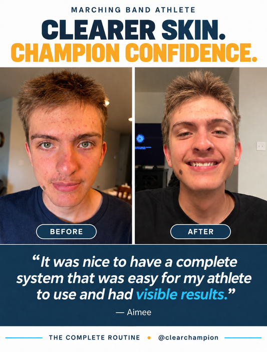 A promotional before-and-after comparison graphic for a skin-clearing routine. The top text reads 'MARCHING BAND ATHLETE' and 'CLEARER SKIN.